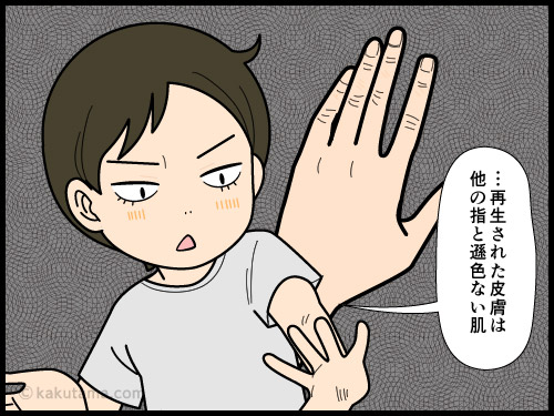 火傷が治って新たにできた皮膚に期待したが、自分の年令と変わらない皮膚が再生されただけだった4コマ漫画
