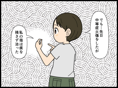 人間は生きているから皮膚が再生するんだな〜と思う4コマ漫画