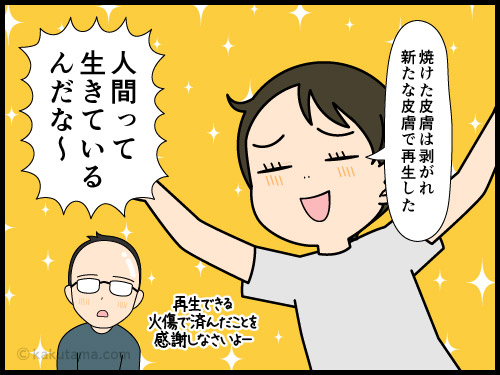 人間は生きているから皮膚が再生するんだな〜と思う4コマ漫画
